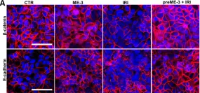 Fig.4.A showing Immunocytochemistry-immunofluorescence in a Homo sapiens (Human) sample from the publication: Protective Effect of Limosilactobacillus fermentum ME-3 against the Increase in Paracellular Permeability Induced by Chemotherapy or Inflammatory Conditions in Caco-2 Cell Models.