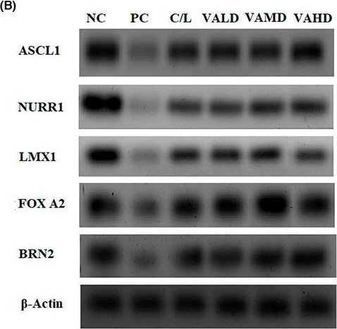 Fig.6.B showing Western Blotting in a Rattus norvegicus (Rat) sample from the publication: Reactive astrocytes targeting with oral vitamin A: Efficient neuronal regeneration for Parkinson's disease treatment and reversal of associated liver fibrosis.
