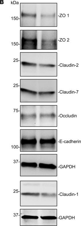 Fig.5.B showing Western Blotting from the publication: Long noncoding RNA GAS5 disrupts intestinal epithelial barrier function by increasing small vault RNA levels.