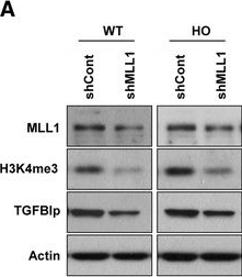 Fig.7.A showing Western Blotting in a Homo sapiens (Human) sample from the publication: Histone methylation levels correlate with TGFBIp and extracellular matrix gene expression in normal and granular corneal dystrophy type 2 corneal fibroblasts.