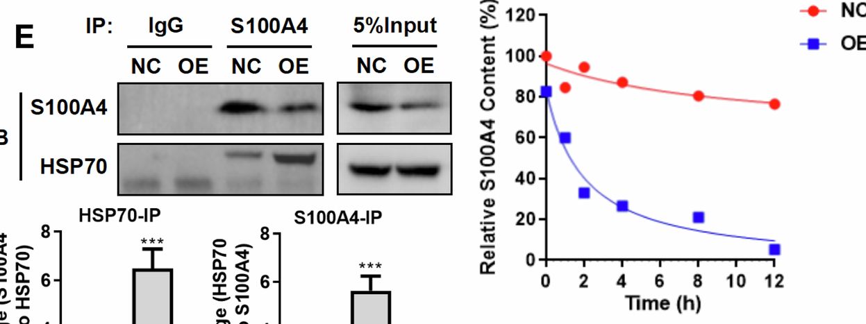 Fig.7.E showing Western Blotting in a Homo sapiens (Human) sample from the publication: Super enhancer lncRNA RP11-54O7.17 regulates the proliferation and metastasis of triple-negative breast cancer by targeting lysosomal degradation of S100A4.