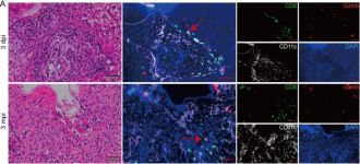 CD11c (D1V9Y) Rabbit Monoclonal Antibody | Cell Signaling Technology