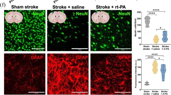 Fig.3.F showing Immunohistochemistry-immunofluorescence from the publication: Cardiovascular exercise mitigates reperfusion failure and persistent hypoperfusion in the thrombin model of stroke and thrombolysis.