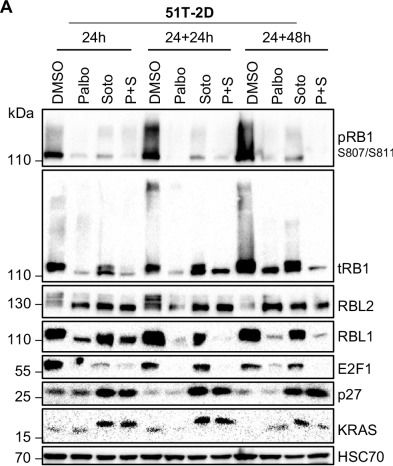 Fig.5.A showing Western Blotting from the publication: Simultaneous targeting of KRAS and CDK4 synergistically induces durable growth arrest in pancreatic cancer cells.