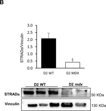 Fig.3.B showing Western Blotting in a Mus musculus (House mouse) sample from the publication: LKB1 signaling is altered in skeletal muscle of a Duchenne muscular dystrophy mouse model.
