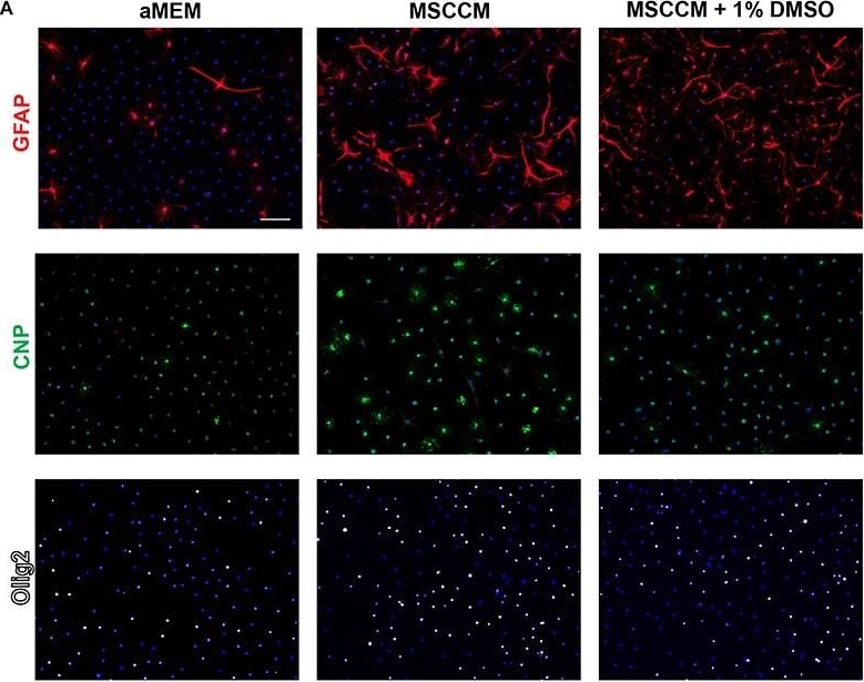 Dimethylsulfoxide Inhibits Oligodendrocyte Fate Choice of Adult Neural Stem and Progenitor Cells.