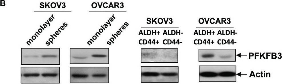 Fig.3.B showing Western Blotting from the publication: PFKFB3 Regulates Chemoresistance, Metastasis and Stemness via IAP Proteins and the NF-κB Signaling Pathway in Ovarian Cancer.