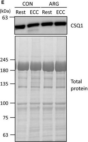 Fig.2.E showing Western Blotting in a Rattus norvegicus (Rat) sample from the publication: l-arginine ingestion inhibits eccentric contraction-induced proteolysis and force deficit via S-nitrosylation of calpain.