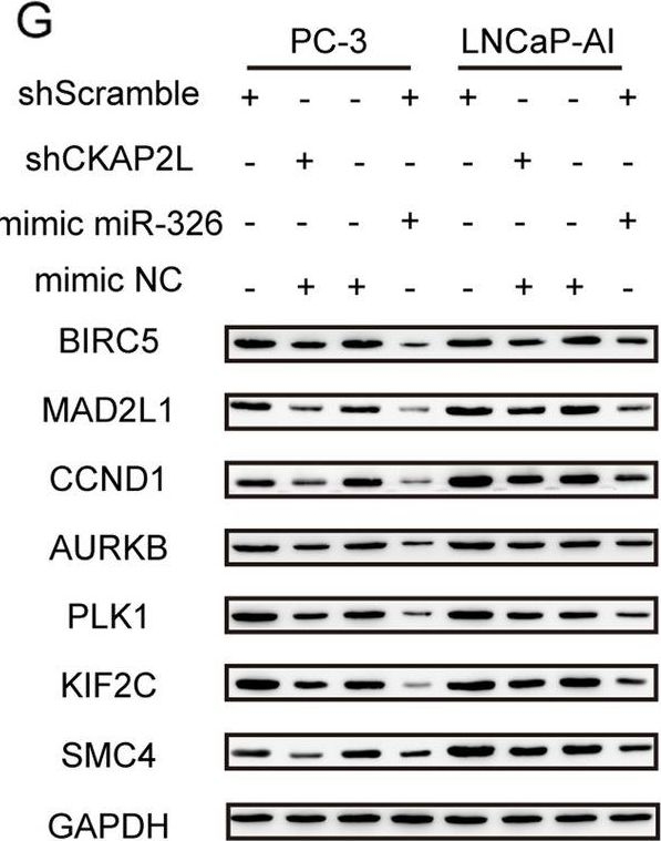 Fig.4.G showing Western Blotting from the publication: CKAP2L, a crucial target of miR-326, promotes prostate cancer progression.