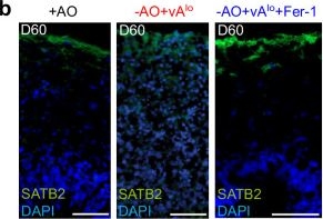 Fig.3.B showing Immunohistochemistry-immunofluorescence from the publication: Suppression of ferroptosis by vitamin A or radical-trapping antioxidants is essential for neuronal development.