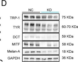 Fig.9.D showing Western Blotting from the publication: Human umbilical cord mesenchymal stem cell delivery of mitochondria to melanocytes enhances skin repigmentation efficacy in autologous epidermal cell suspension transplantation through the TNFAIP2-TNT system.