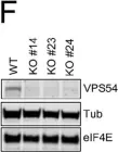Fig.2.F showing Western Blotting from the publication: Repurposing Itraconazole and Hydroxychloroquine to Target Lysosomal Homeostasis in Epithelial Ovarian Cancer.
