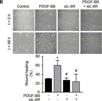 Fig.5.B from the publication: Soluble Interleukin-6 Receptor Regulates Interleukin-6-Dependent Vascular Remodeling in Long-Distance Runners.