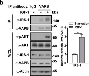 Fig.2.B showing Western Blotting from the publication: VAPB-mediated ER-targeting stabilizes IRS-1 signalosomes to regulate insulin/IGF signaling.
