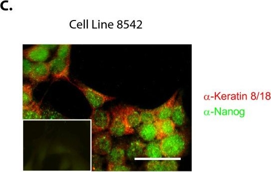 NOTCH1 inhibition in vivo results in mammary tumor regression and reduced mammary tumorsphere-forming activity in vitro.