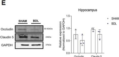 Fig.1.E showing Western Blotting in a Mus musculus (House mouse) sample from the publication: Exendin-4 protects brain endothelial cell damage against hyperammonemic condition.
