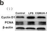 Fig.3.B showing Western Blotting in a Mus musculus (House mouse) sample from the publication: CQMUH-011 Inhibits LPS-Induced Microglia Activation and Ameliorates Brain Ischemic Injury in Mice.