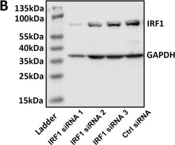 Fig.7.B showing Western Blotting from the publication: The Role of Interferon Regulatory Factor 1 in Regulating Microglial Activation and Retinal Inflammation.