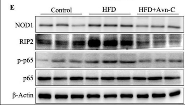 Fig.7.E showing Western Blotting from the publication: Avenanthramide-C Mitigates High-Fat Diet-Accelerated Alzheimer's Pathologies via NOD1-Driven Neuroinflammation in 5×FAD Mice.