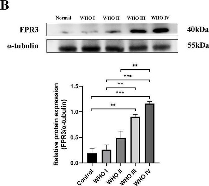 Fig.6.B showing Western Blotting in a Homo sapiens (Human) sample from the publication: Pan-cancer analysis and experimental validation of FPR3 as a prognostic and immune infiltration-related biomarker for glioma.