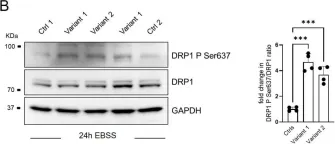 Fig.3.B showing Western Blotting from the publication: Converging Role for REEP1/SPG31 in Oxidative Stress.