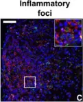 Fig.7.C showing Immunohistochemistry-immunofluorescence in a Mus musculus (House mouse) sample from the publication: IFN-gamma signaling in the central nervous system controls the course of experimental autoimmune encephalomyelitis independently of the localization and composition of inflammatory foci.