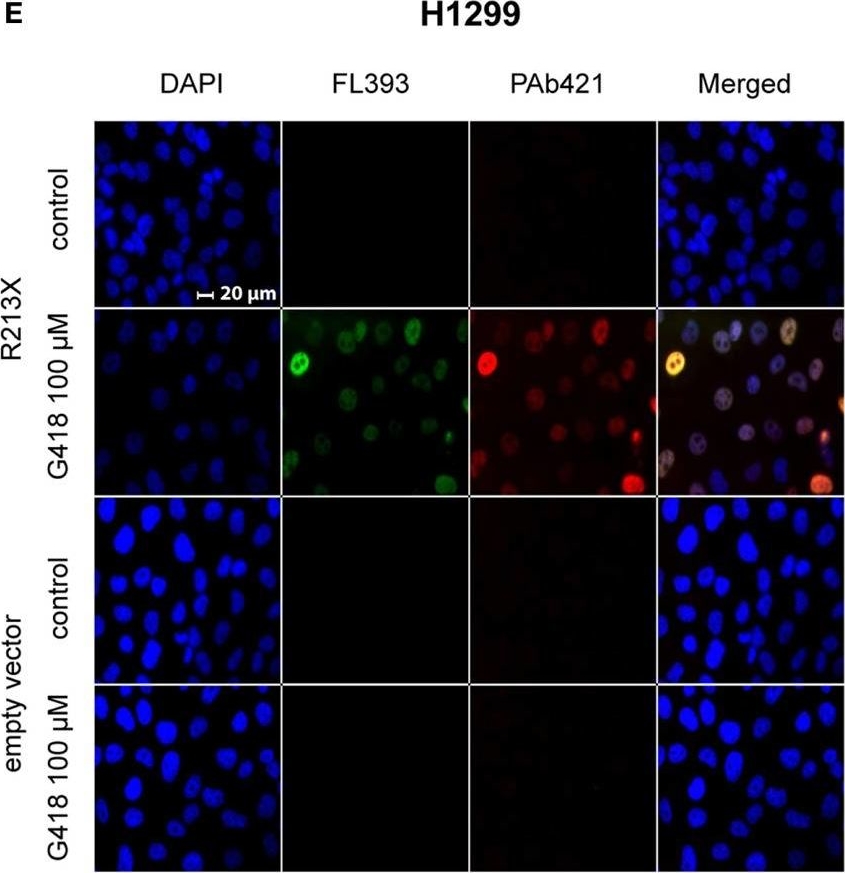 Fig.1.E showing Immunocytochemistry-immunofluorescence in a Homo sapiens (Human) sample from the publication: Synergistic Rescue of Nonsense Mutant Tumor Suppressor p53 by Combination Treatment with Aminoglycosides and Mdm2 Inhibitors.