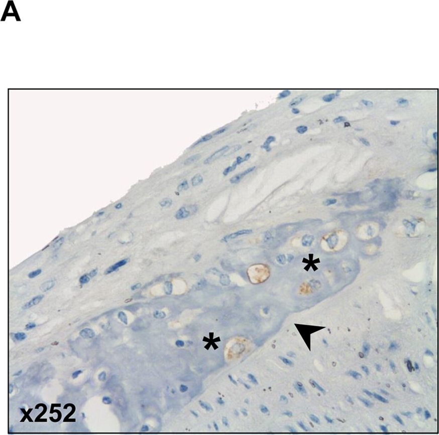 Fig.3.A showing Immunohistochemistry in a Mus musculus (House mouse) sample from the publication: T cell-specific overexpression of TGFß1 fails to influence atherosclerosis in ApoE-deficient mice.
