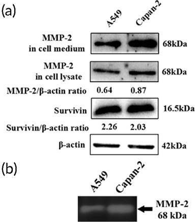 Fig.3.A showing Western Blotting from the publication: Multistage targeting and dual inhibiting strategies based on bioengineered tumor matrix microenvironment-mediated protein nanocages for enhancing cancer biotherapy.
