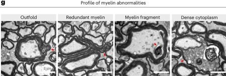 Fig.1.G showing Immunohistochemistry in a Mus musculus (House mouse) sample from the publication: TGFβ signaling mediates microglial resilience to spatiotemporally restricted myelin degeneration.