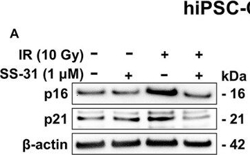 Fig.5.A showing Western Blotting from the publication: Mitochondrial-targeted SS-31 peptide attenuates radiation-induced cardiomyocyte senescence.