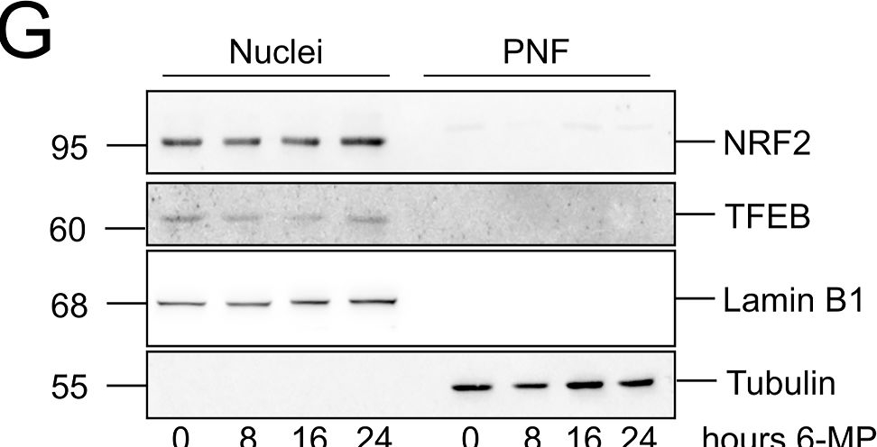 Fig.5.G showing Western Blotting from the publication: The inhibition of de novo purine synthesis increases LAMP2 expression to preserve cell viability.