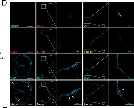 Fig.3.D showing Immunocytochemistry-immunofluorescence in a Homo sapiens (Human) sample from the publication: Human epicardial organoids from pluripotent stem cells resemble fetal stage with potential cardiomyocyte- transdifferentiation.