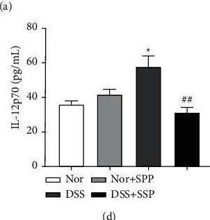 Fig.2.A showing Enzyme-linked immunosorbent assay from the publication: Sishen Pill Ameliorates Dextran Sulfate Sodium (DSS)-Induced Colitis with Spleen-Kidney Yang Deficiency Syndromes: Role of Gut Microbiota, Fecal Metabolites, Inflammatory Dendritic Cells, and TLR4/NF-κB Pathway.