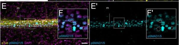 Miページ Phospho-SMAD1 (Ser463/465)/ SMAD5 (Ser463/465)/ SMAD9 (Ser465/467