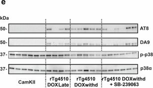 Fig.2.E showing Western Blotting in a Mus musculus (House mouse) sample from the publication: Aberrant tau accumulation caused by MAPT mutations induces early pathological changes in axonal transport that are rescued by p38α inhibition.