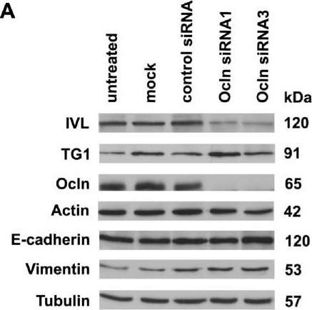 Occludin is involved in adhesion, apoptosis, differentiation and Ca2+-homeostasis of human keratinocytes: implications for tumorigenesis.