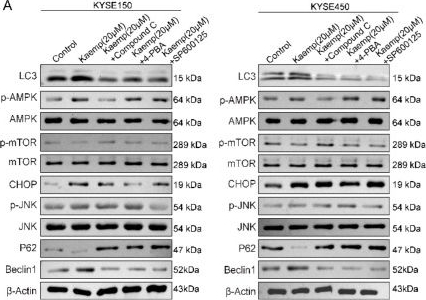 Fig.7.A showing Western Blotting from the publication: Dose-dependent tuning of HSP70-Beclin-1 by kaempferol governs autophagy and chemosensitivity.