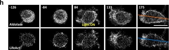 Fig.5.H showing Immunocytochemistry-immunofluorescence in a Homo sapiens (Human) sample from the publication: Self-organizing glycolytic waves tune cellular metabolic states and fuel cancer progression.