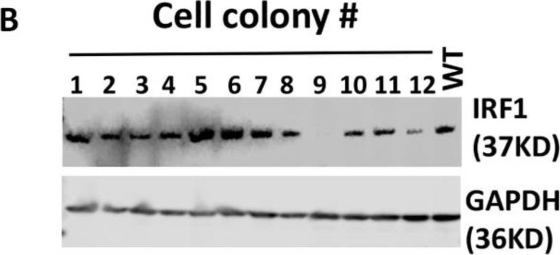 Fig.2.B showing Western Blotting from the publication: The Role of Interferon Regulatory Factor 1 in Regulating Microglial Activation and Retinal Inflammation.
