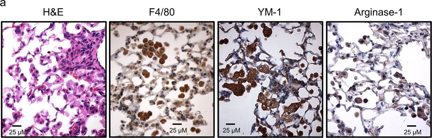 Fig.2.A showing Immunohistochemistry in a Mus musculus (House mouse) sample from the publication: IL-13 is a therapeutic target in radiation lung injury.