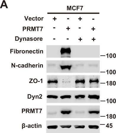 Fig.7.A showing Western Blotting in a Homo sapiens (Human) sample from the publication: Arginine methylation of SHANK2 by PRMT7 promotes human breast cancer metastasis through activating endosomal FAK signalling.