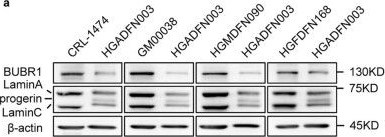 Fig.2.A showing Western Blotting from the publication: Unique progerin C-terminal peptide ameliorates Hutchinson-Gilford progeria syndrome phenotype by rescuing BUBR1.