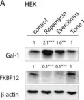Fig.6.A showing Western Blotting from the publication: Rapalogs can promote cancer cell stemness in vitro in a Galectin-1 and H-ras-dependent manner.