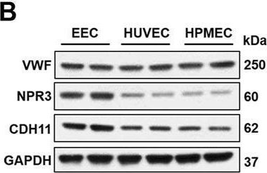 Fig.2.B showing Western Blotting from the publication: PLXND1-mediated calcium dyshomeostasis impairs endocardial endothelial autophagy in atrial fibrillation.