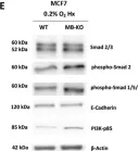 Fig.2.E showing Western Blotting from the publication: Pro-Apoptotic and Anti-Invasive Properties Underscore the Tumor-Suppressing Impact of Myoglobin on a Subset of Human Breast Cancer Cells.