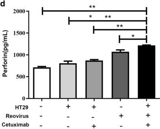 Fig.2.D showing Enzyme-linked immunosorbent assay from the publication: Reovirus enhances cytotoxicity of natural killer cells against colorectal cancer via TLR3 pathway.