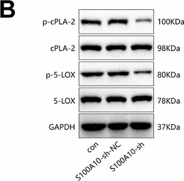 Fig.5.B showing Western Blotting in a Mus musculus (House mouse) sample from the publication: Elucidating the role of S100A10 in CD8+ T cell exhaustion and HCC immune escape via the cPLA2 and 5-LOX axis.