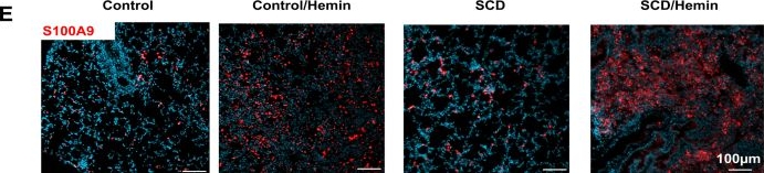 Fig.1.E showing Immunohistochemistry-immunofluorescence in a Mus musculus (House mouse) sample from the publication: Spleen Tyrosine Kinase Inhibition Mitigates Hemin-Induced Thromboinflammation in an Organ-Specific Manner in Sickle Cell Mice.