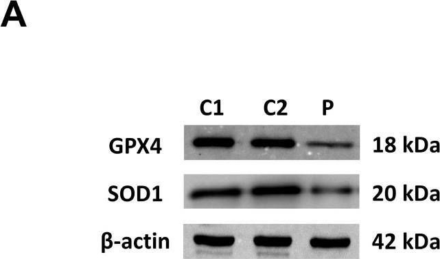Fig.5.A showing Western Blotting in a Homo sapiens (Human) sample from the publication: Mitochondrial Unfolded Protein Response (mtUPR) Activation Improves Pathological Alterations in Cellular Models of Ethylmalonic Encephalopathy.